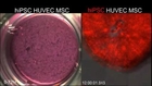 Liver Bud Growth from Human iPS Cells